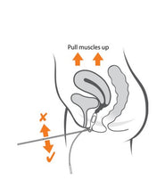 Load image into Gallery viewer, PR-08A Vaginal Electrode (Periform Replacement)